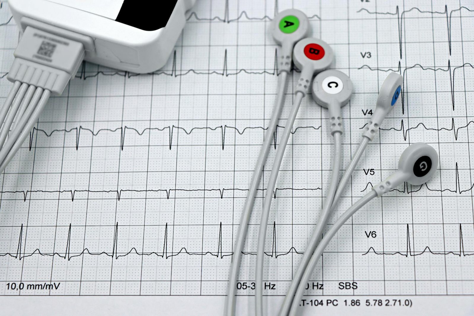 Illustration of Echo Test Hyderabad: Must-Have Cardiac Imaging by Nishant Cardio Care