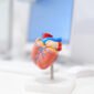 Heart Screening Hyderabad Must Have Cardiac Diagnostics for Working Professionals 85x85
